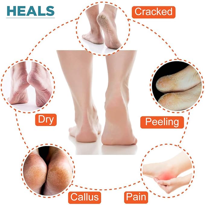 IZZORI Silicone Gel Heel Socks for Dry Hard Cracked Heel Repair Pad, Swelling & Pain Relief, Cushion Support, Foot Care, Ankle Protection, Plantar Fasciitis for Men and Women (Free Size, Blue, 1 Pair)