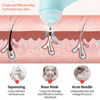 0288 Vacuum Blackhead Machine Reduce Spot Mini Handheld Lifting Massage Facial Blackhead Remover For Skin Care (1 Pc)